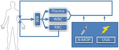 Extracorporeal Photopheresis—An Overview